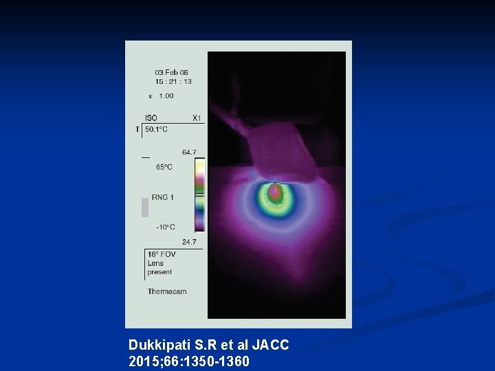 Dukkipati S. R et al JACC 2015; 66: 1350 -1360 Dukkipati S. R et al JACC 2015; 66: 1350 -1360
