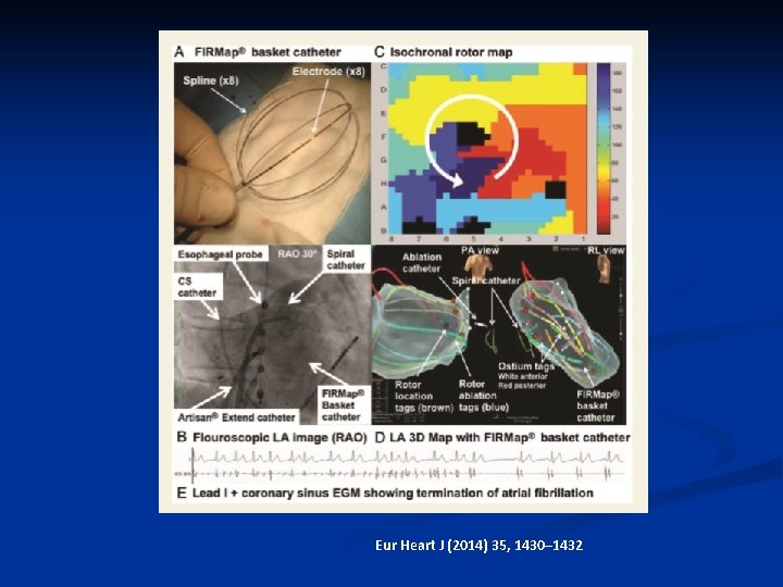 Eur Heart J (2014) 35, 1430– 1432 Eur Heart J (2014) 35, 1430– 1432