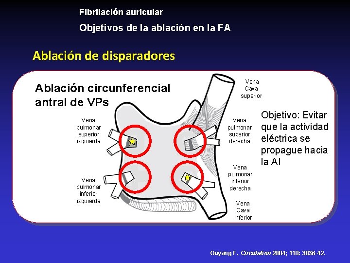 Fibrilación auricular Objetivos de la ablación en la FA Ablación de disparadores Ablación circunferencial Fibrilación auricular Objetivos de la ablación en la FA Ablación de disparadores Ablación circunferencial