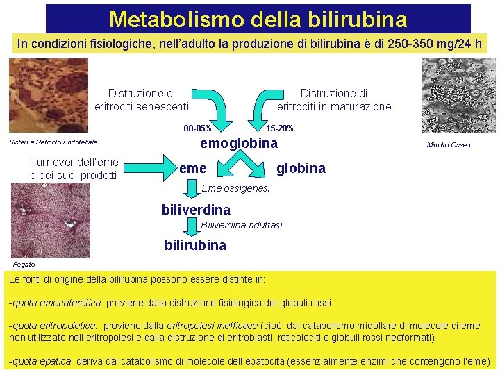 Metabolismo della bilirubina In condizioni fisiologiche, nell’adulto la produzione di bilirubina è di 250
