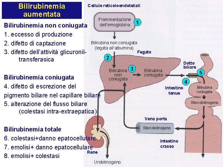 Bilirubinemia aumentata Bilirubinemia non coniugata 1. eccesso di produzione 2. difetto di captazione 3.