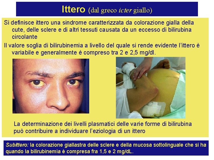 Ittero (dal greco icter giallo) Si definisce ittero una sindrome caratterizzata da colorazione gialla