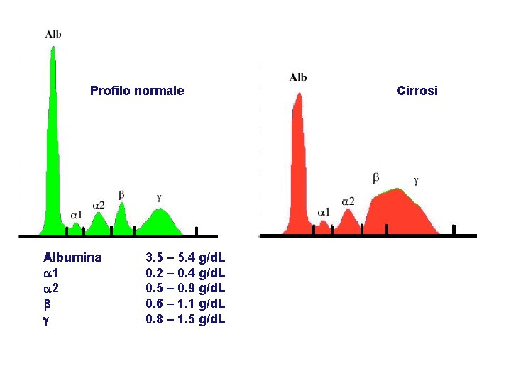 Profilo normale Albumina a 1 a 2 3. 5 – 5. 4 g/d. L