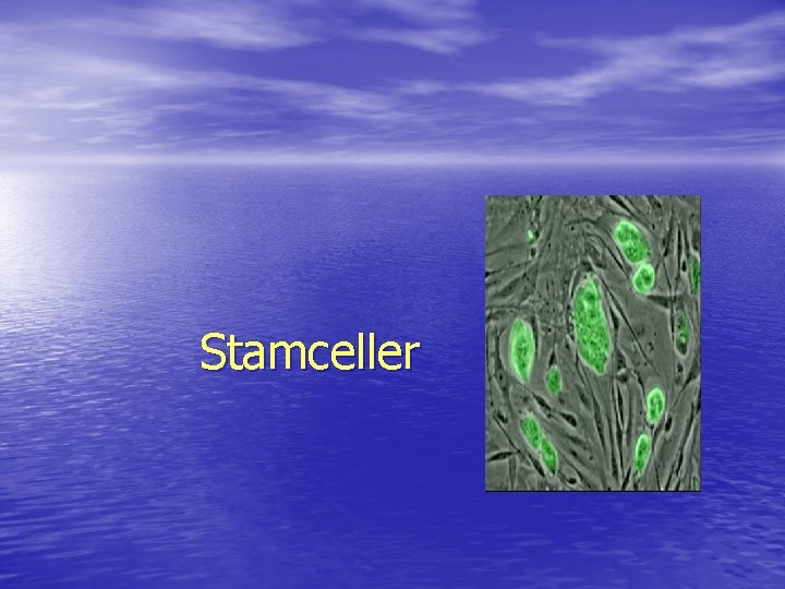 Stamceller 
