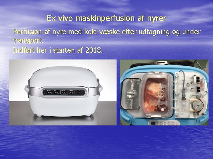 Ex vivo maskinperfusion af nyrer Perfusion af nyre med kold væske efter udtagning og