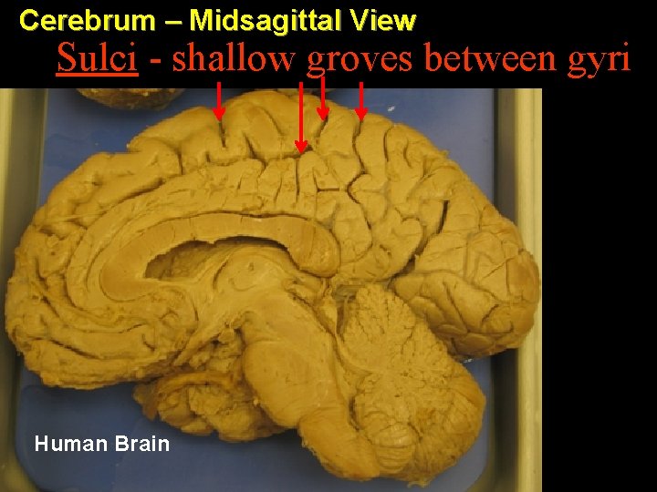 Cerebrum – Midsagittal View Sulci - shallow groves between gyri Human Brain 