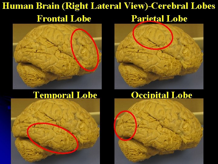 Human Brain (Right Lateral View)-Cerebral Lobes Frontal Lobe Parietal Lobe Temporal Lobe Occipital Lobe