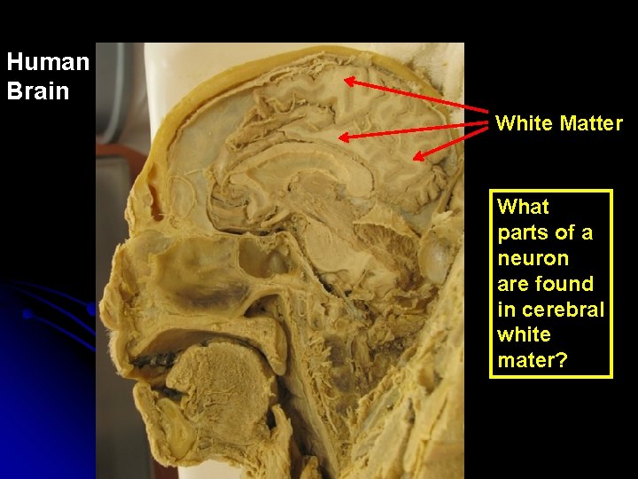 Human Brain White Matter What parts of a neuron are found in cerebral white
