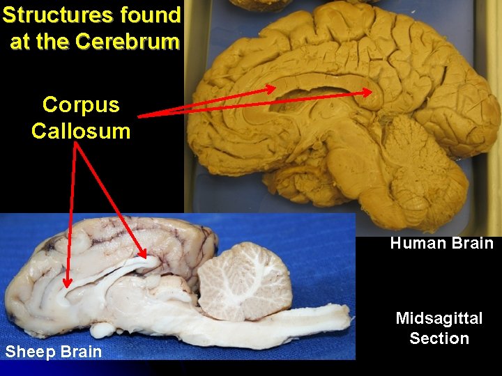 Structures found at the Cerebrum Corpus Callosum Human Brain Sheep Brain Midsagittal Section 