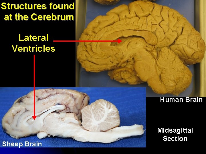 Structures found at the Cerebrum Lateral Ventricles Human Brain Sheep Brain Midsagittal Section Structures found at the Cerebrum Lateral Ventricles Human Brain Sheep Brain Midsagittal Section