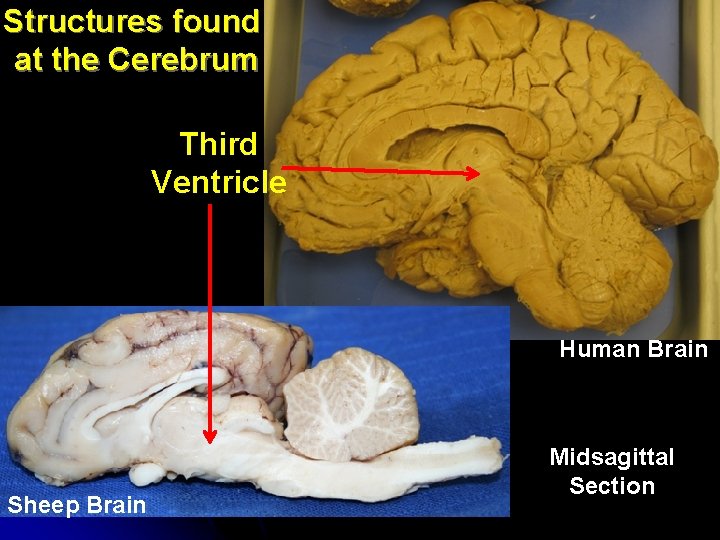 Structures found at the Cerebrum Third Ventricle Human Brain Sheep Brain Midsagittal Section Structures found at the Cerebrum Third Ventricle Human Brain Sheep Brain Midsagittal Section