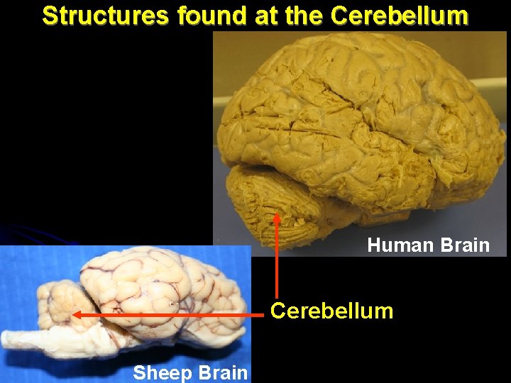 Structures found at the Cerebellum Human Brain Cerebellum Sheep Brain 