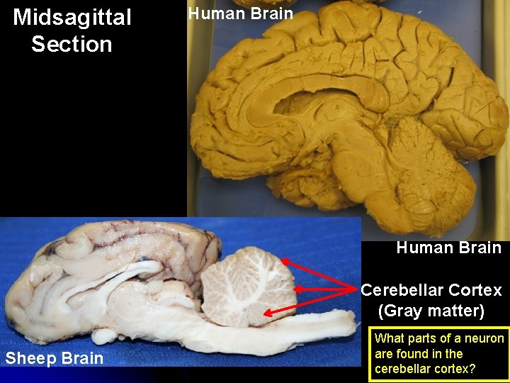 Midsagittal Section Human Brain Cerebellar Cortex (Gray matter) Sheep Brain What parts of a