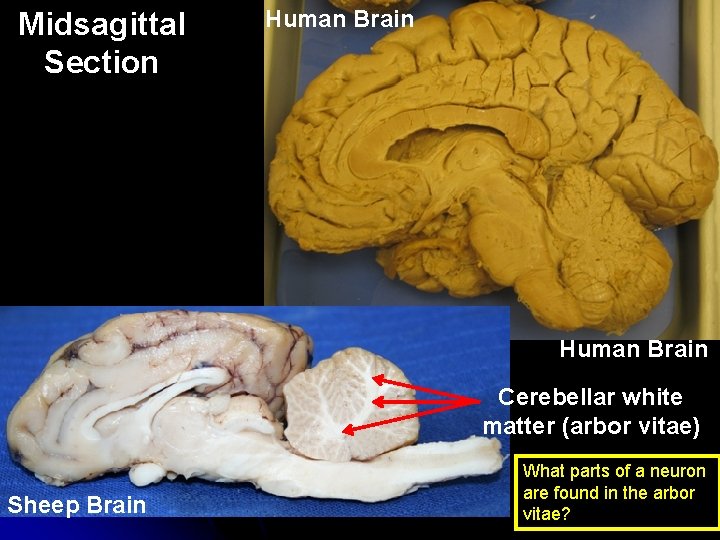 Midsagittal Section Human Brain Cerebellar white matter (arbor vitae) Sheep Brain What parts of
