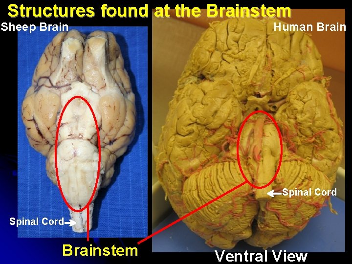 Structures found at the Brainstem Sheep Brain Human Brain Spinal Cord Brainstem Ventral View