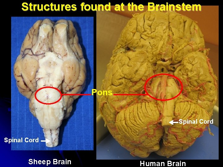 Structures found at the Brainstem Pons Spinal Cord Sheep Brain Human Brain Structures found at the Brainstem Pons Spinal Cord Sheep Brain Human Brain
