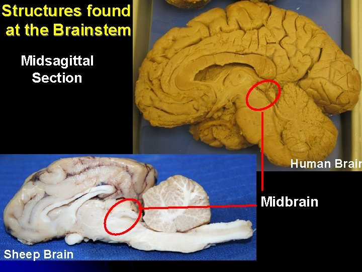 Structures found at the Brainstem Midsagittal Section Human Brain Midbrain Sheep Brain 