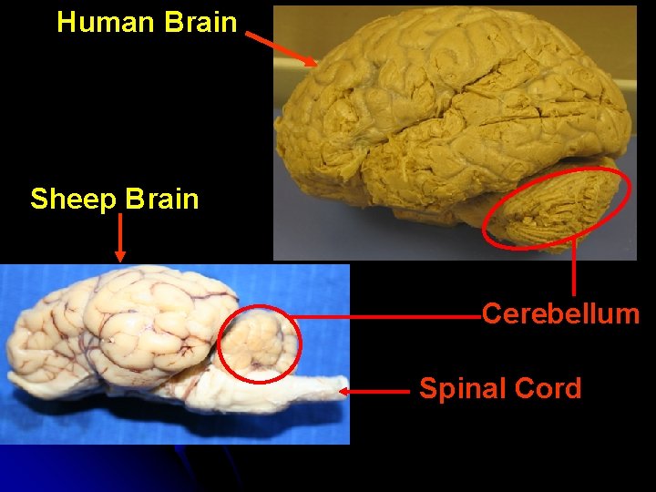 Human Brain Sheep Brain Cerebellum Spinal Cord Human Brain Sheep Brain Cerebellum Spinal Cord
