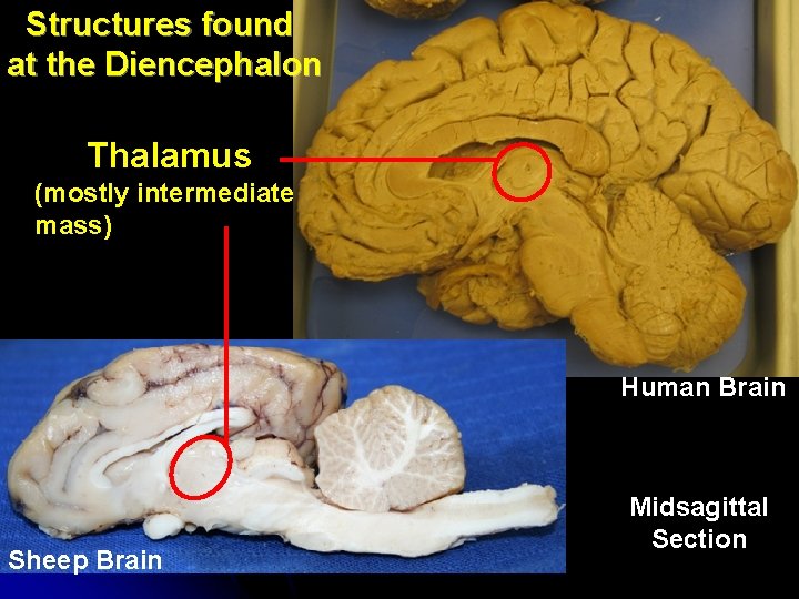 Structures found at the Diencephalon Thalamus (mostly intermediate mass) Human Brain Sheep Brain Midsagittal Structures found at the Diencephalon Thalamus (mostly intermediate mass) Human Brain Sheep Brain Midsagittal