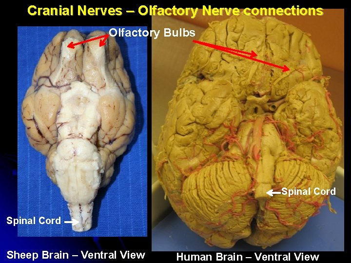 Cranial Nerves – Olfactory Nerve connections Olfactory Bulbs Spinal Cord Sheep Brain – Ventral Cranial Nerves – Olfactory Nerve connections Olfactory Bulbs Spinal Cord Sheep Brain – Ventral