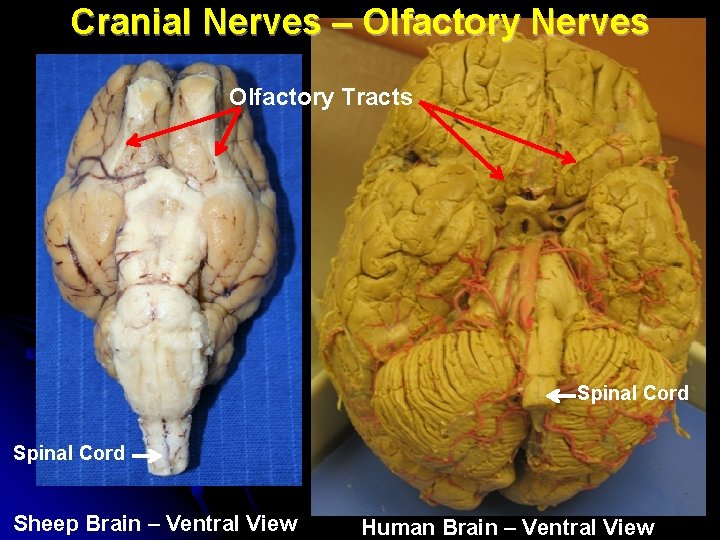 Cranial Nerves – Olfactory Nerves Olfactory Tracts Spinal Cord Sheep Brain – Ventral View