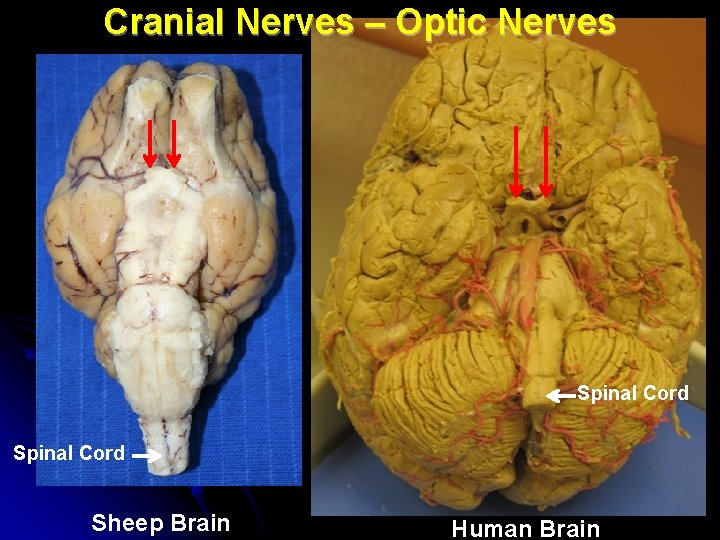 Cranial Nerves – Optic Nerves Spinal Cord Sheep Brain Human Brain 