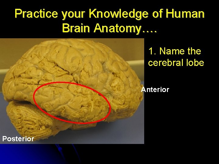 Practice your Knowledge of Human Brain Anatomy…. 1. Name the cerebral lobe Anterior Posterior