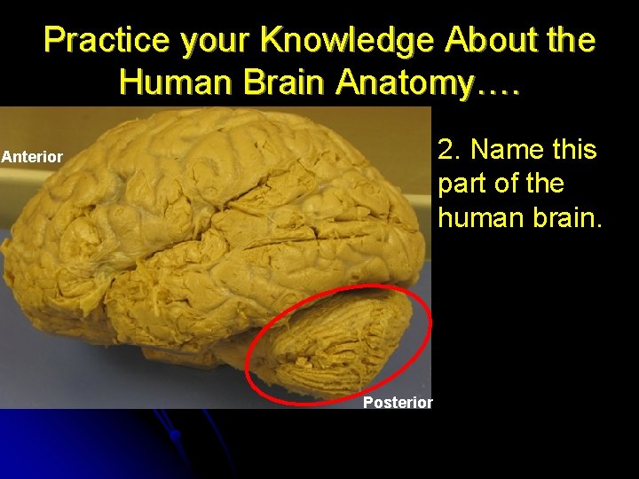 Practice your Knowledge About the Human Brain Anatomy…. 2. Name this part of the