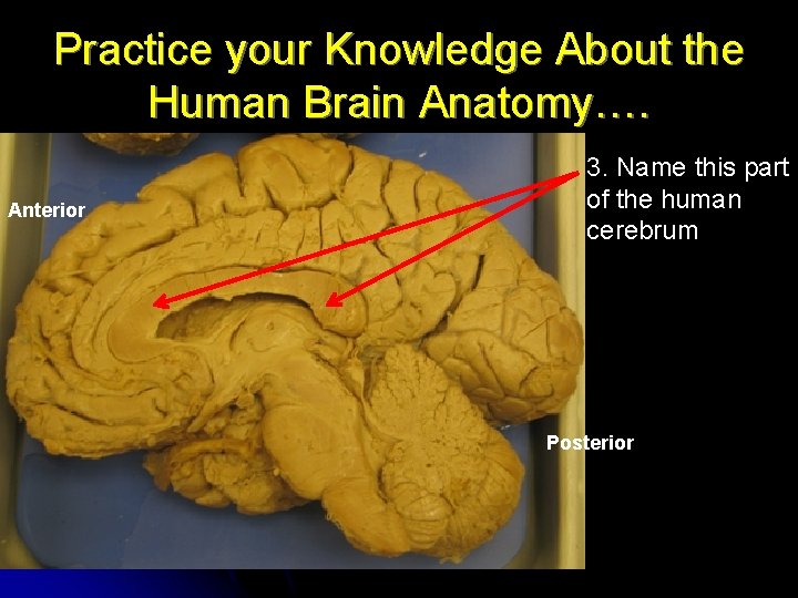 Practice your Knowledge About the Human Brain Anatomy…. Anterior 3. Name this part of Practice your Knowledge About the Human Brain Anatomy…. Anterior 3. Name this part of