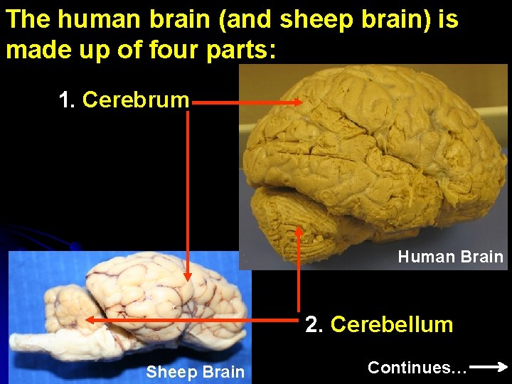 The human brain (and sheep brain) is made up of four parts: 1. Cerebrum The human brain (and sheep brain) is made up of four parts: 1. Cerebrum
