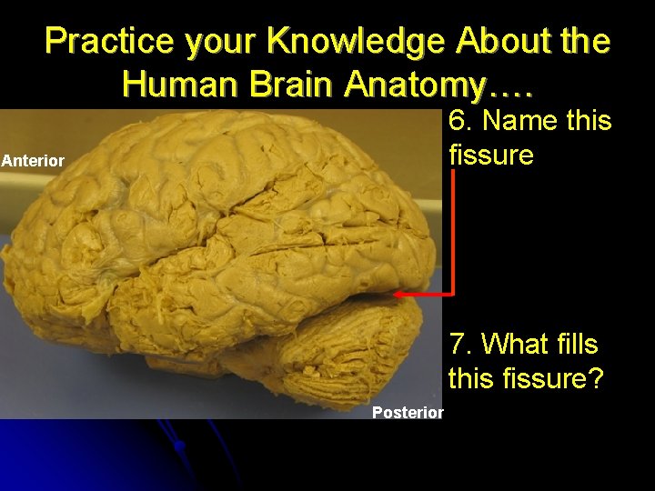 Practice your Knowledge About the Human Brain Anatomy…. 6. Name this fissure Anterior Posterior Practice your Knowledge About the Human Brain Anatomy…. 6. Name this fissure Anterior Posterior