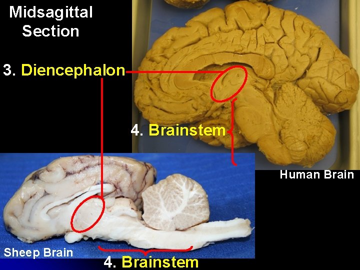 Midsagittal Section 3. Diencephalon 4. Brainstem Human Brain Sheep Brain 4. Brainstem Midsagittal Section 3. Diencephalon 4. Brainstem Human Brain Sheep Brain 4. Brainstem