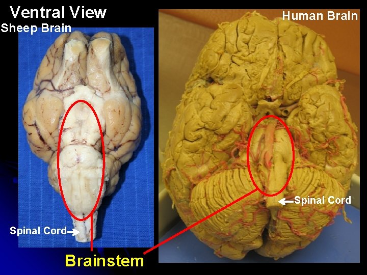 Ventral View Sheep Brain Human Brain Spinal Cord Brainstem 
