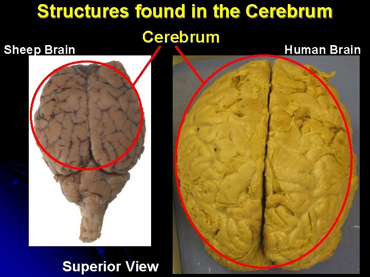 Structures found in the Cerebrum Sheep Brain Cerebrum Superior View Human Brain Structures found in the Cerebrum Sheep Brain Cerebrum Superior View Human Brain