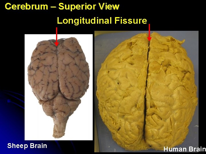 Cerebrum – Superior View Longitudinal Fissure Sheep Brain Human Brain 
