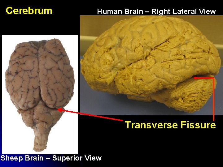 Cerebrum Human Brain – Right Lateral View Transverse Fissure Sheep Brain – Superior View Cerebrum Human Brain – Right Lateral View Transverse Fissure Sheep Brain – Superior View