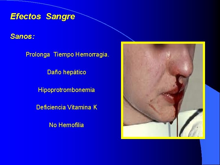 Efectos Sangre Sanos: Prolonga Tiempo Hemorragia. Daño hepático Hipoprotrombonemia Deficiencia Vitamina K No Hemofilia