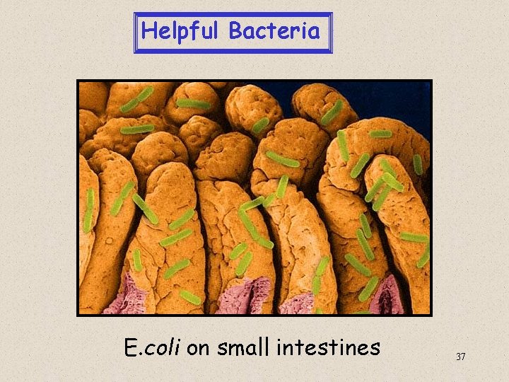 Helpful Bacteria E. coli on small intestines 37 