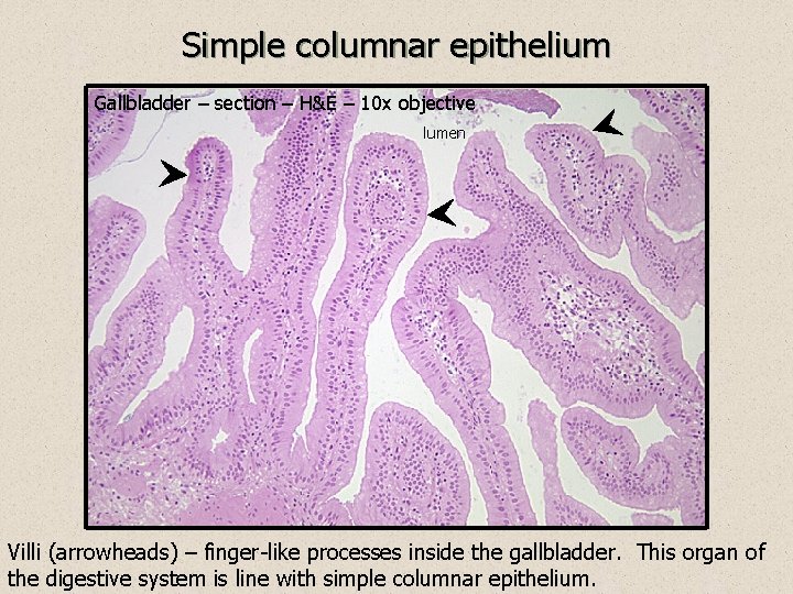 Simple columnar epithelium Gallbladder – section – H&E – 10 x objective lumen Villi