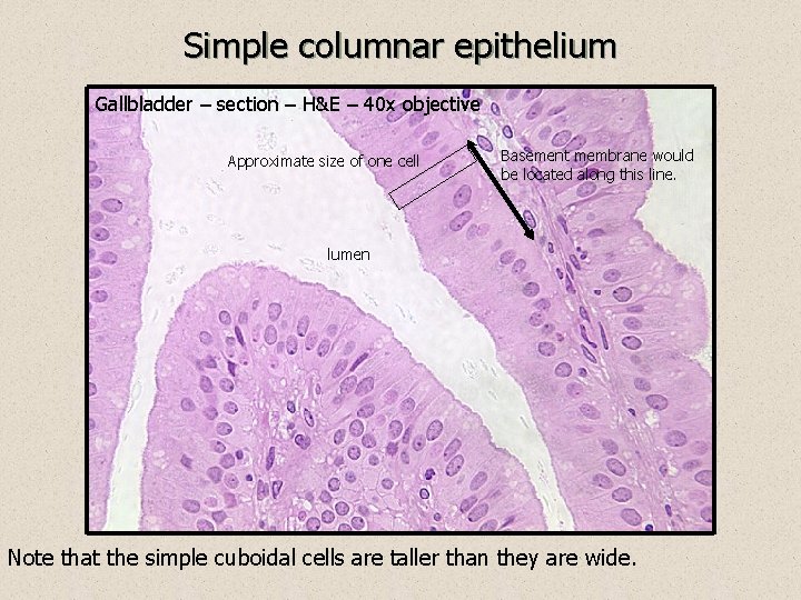 Simple columnar epithelium Gallbladder – section – H&E – 40 x objective Approximate size