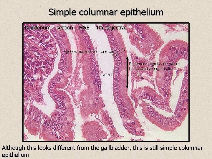 Simple columnar epithelium Duodenum – section – H&E – 40 x objective Approximate size