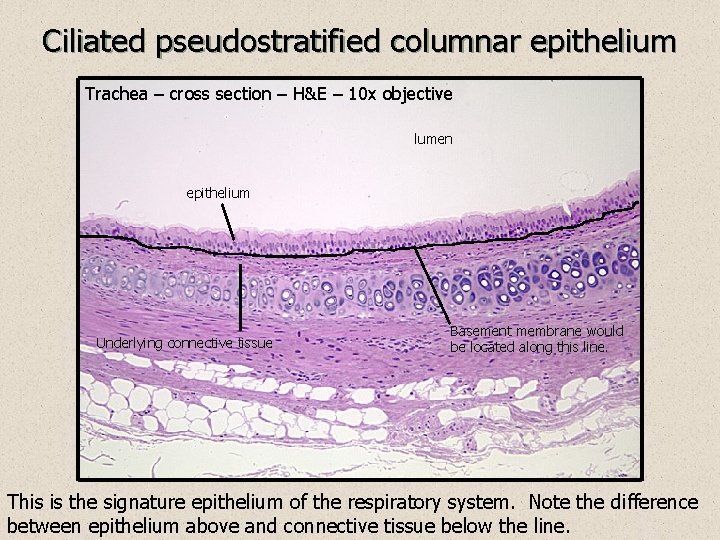 Ciliated pseudostratified columnar epithelium Trachea – cross section – H&E – 10 x objective