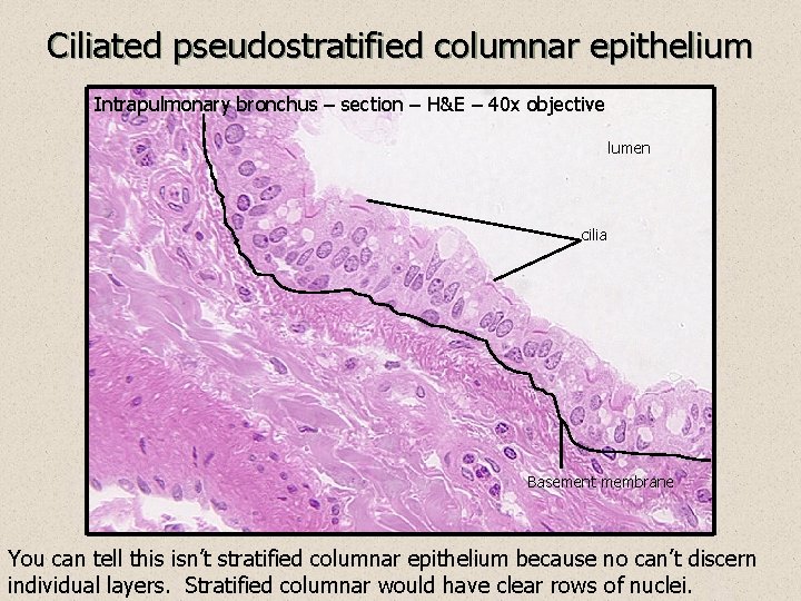 Ciliated pseudostratified columnar epithelium Intrapulmonary bronchus – section – H&E – 40 x objective
