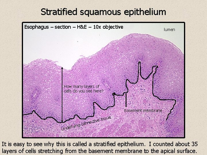 Stratified squamous epithelium Esophagus – section – H&E – 10 x objective lumen How