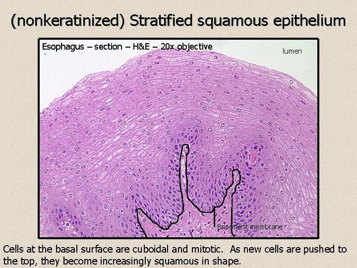 (nonkeratinized) Stratified squamous epithelium Esophagus – section – H&E – 20 x objective lumen