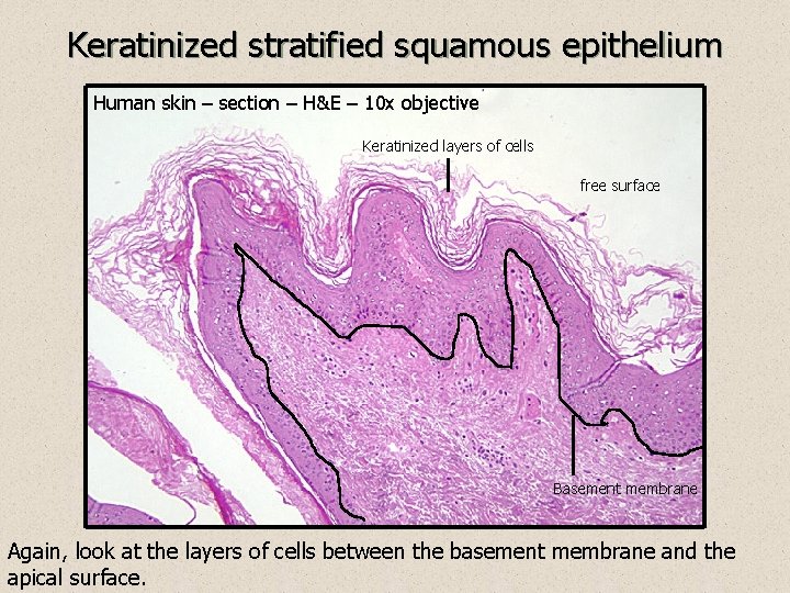 Keratinized stratified squamous epithelium Human skin – section – H&E – 10 x objective
