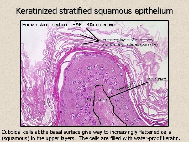 Keratinized stratified squamous epithelium Human skin – section – H&E – 40 x objective