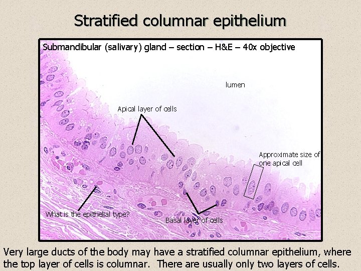 Stratified columnar epithelium Submandibular (salivary) gland – section – H&E – 40 x objective