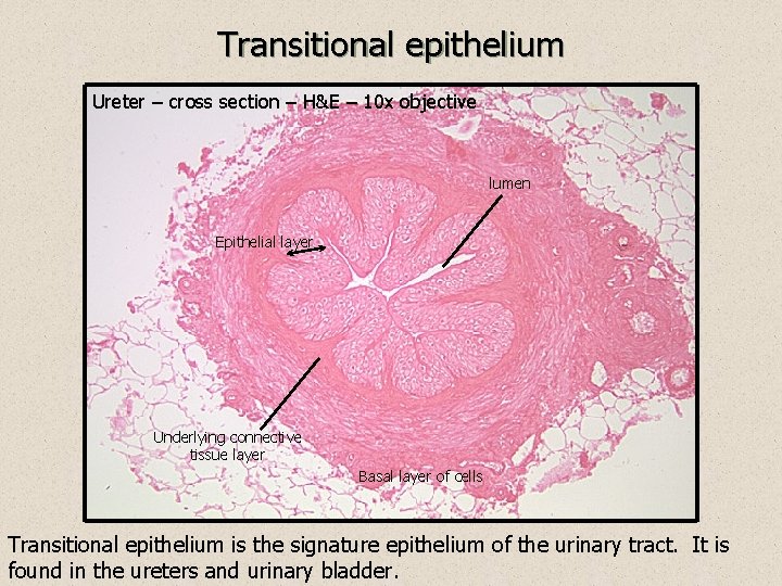 Transitional epithelium Ureter – cross section – H&E – 10 x objective lumen Epithelial