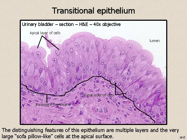 Transitional epithelium Urinary bladder – section – H&E – 40 x objective Apical layer
